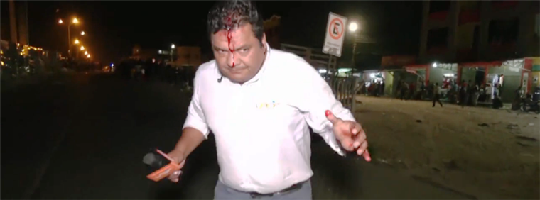 Joaquín Matías, periodista de Red Uno, agredido en el Plan Tres Mil