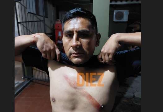 William Medina fue agredido en el hotel de los árbitros. Fotos: ABAF