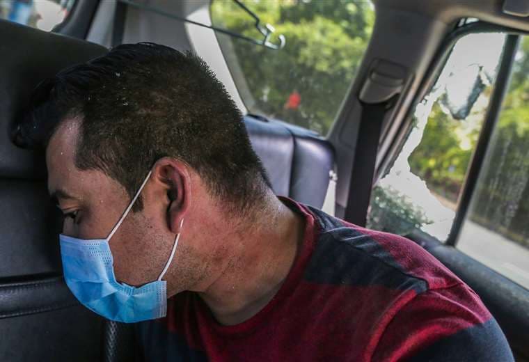 El nicaragüense Josué Garay muestra sus heridas. Foto: AFP
