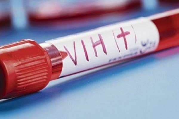 Las personas con VIH sufren con la cuarentena