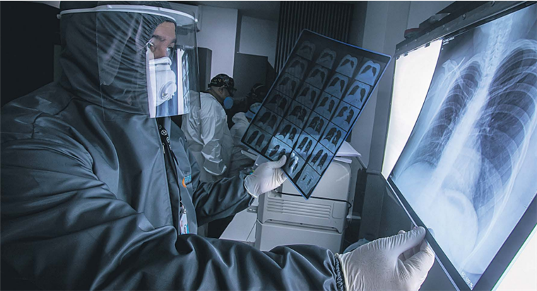 Future–Imágenes Médicas, especialistas analizan una radiografía de pulmones para detectar Covid-19