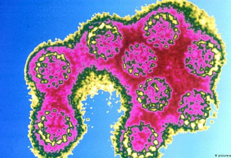 ¿Causa el virus del papiloma humano cáncer de próstata?