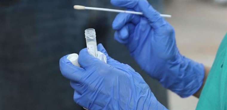 La prueba PCR es la que se usa para registros oficiales