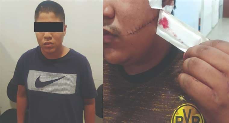 Un joven fue atacado por un menor de edad que obedecía a la embarazada