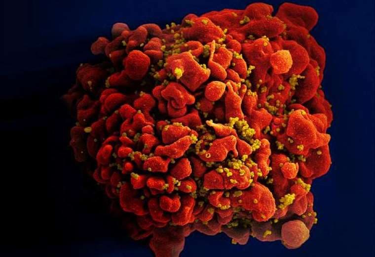 Esta foto muestra un glóbulo blanco humano infectado con el virus del VIH | Foto: AFP