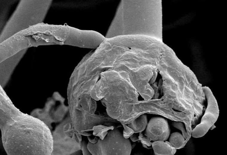 Imagen referencial: el hongo negro ataca principalmente a las vías respiratorias. 