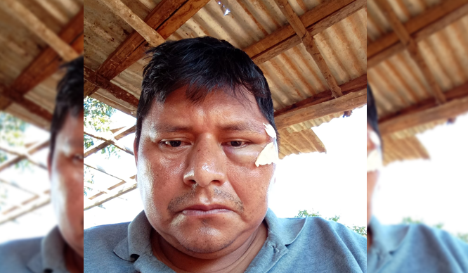 Asambleísta indígena guarayo fue agredido en disputa  en Ascensión