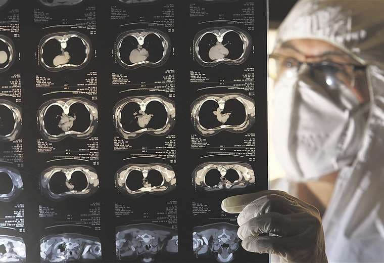 Las tomografías permiten conocer el daño pulmonar. Foto: R. Montero