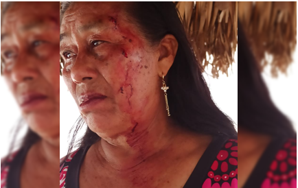 Disputas por la dirigencia en Yaguarú se saldan con una mujer herida