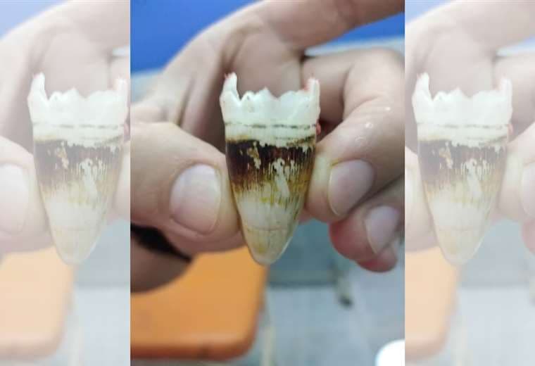 Un pedazo de diente de caimán que fue extraído de las heridas de la joven