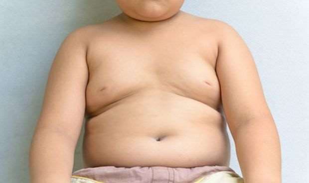 3 de cada 10 niños entre los 5 y 19 años viven con sobrepeso /Foto: Redacción Médica