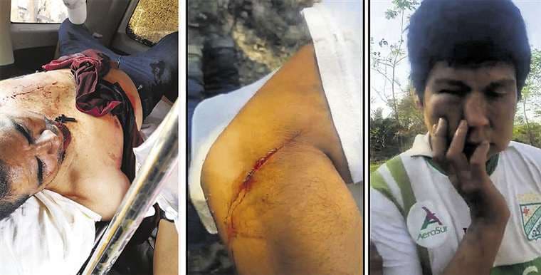 Juan Montaño López tiene tres heridas de bala producto de enfrentamientos. Foto:Ricardo M.
