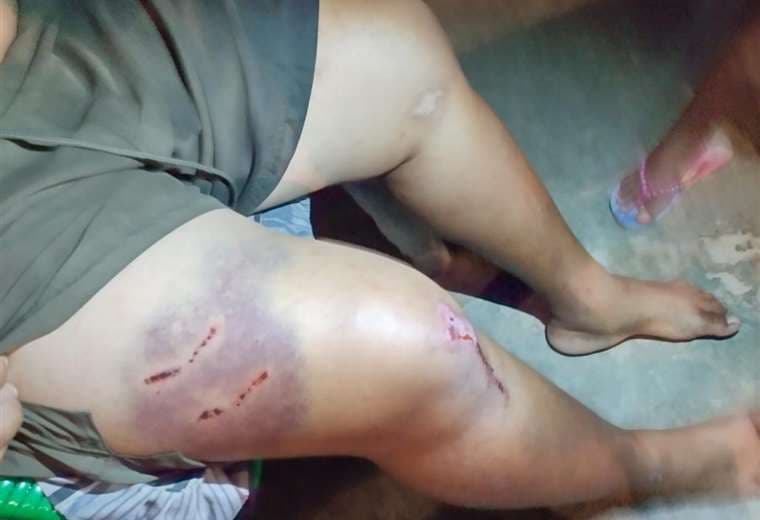 El hombre quedó con heridas por el ataque del perro Foto: Gentileza Rodrigo Salvatierra