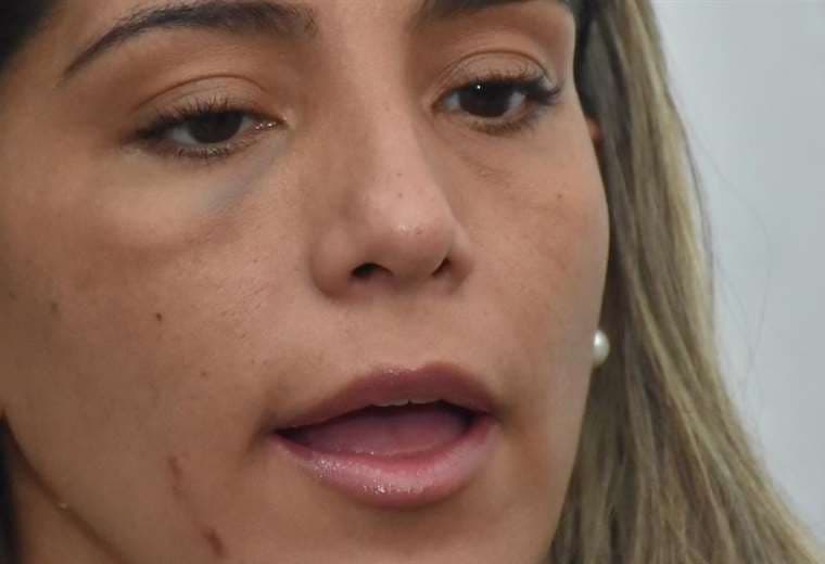 Carolina Ribera luce los golpes que recibió en el penal de Miraflores (Foto: APG Noticias)