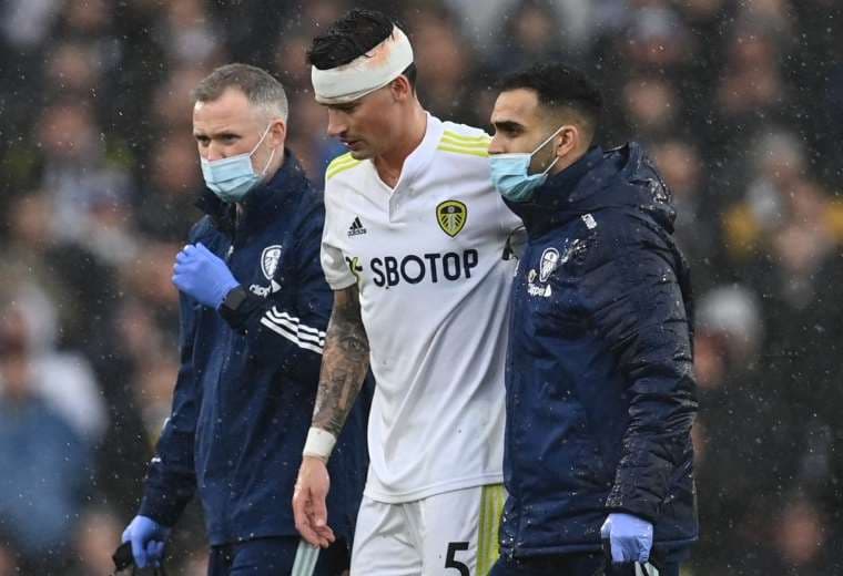Robin Koch, del Leeds United, se lesionó el cráneo el domingo. Foto: AFP 