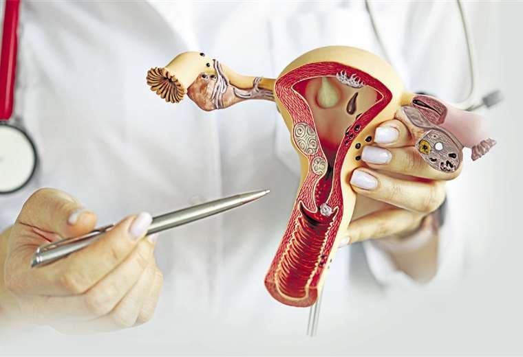 ¿Qué es el síndrome de ovario poliquístico?