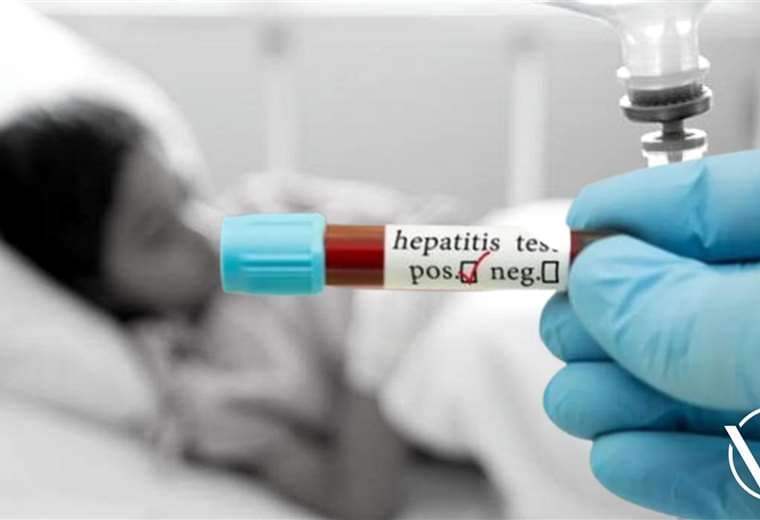 Hepatitis (foto referencial)