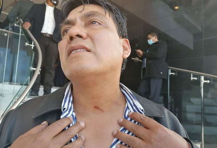 Héctor Arce muestra las heridas que sufrió