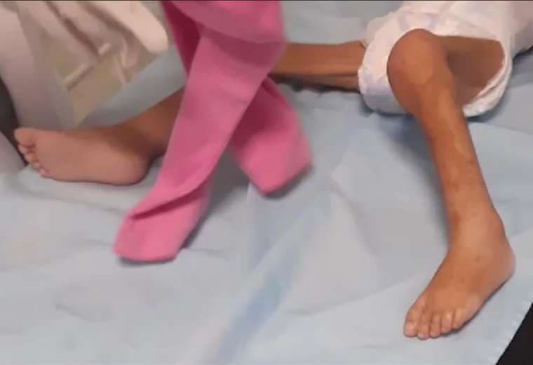 La pequeña recibe atención en el hospital de niños Mario Ortiz 