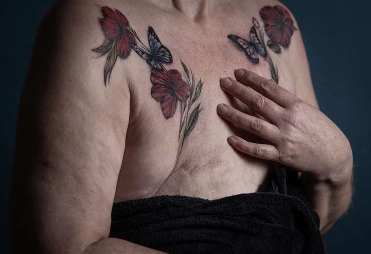 Tatuaje gratuito en los Países Bajos para sobrevivientes del cáncer de seno
