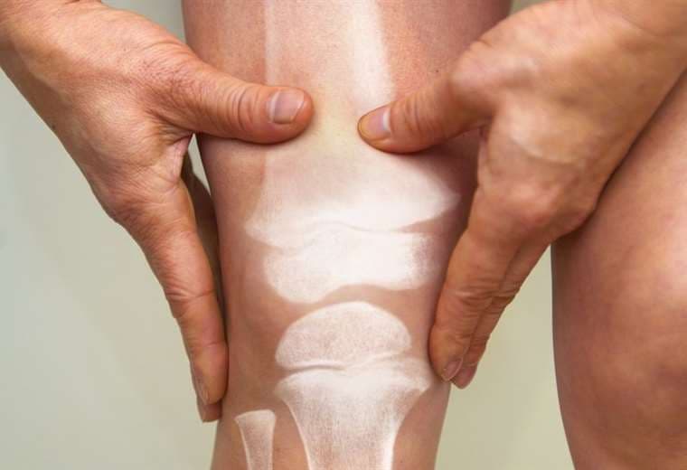 Osteoporosis masculina: la enfermedad silenciosa que cada año causa fracturas a miles de hombres en el mundo