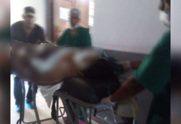 En Urubichá, un hombre quedó herido de gravedad después de ser atacado por un jaguar