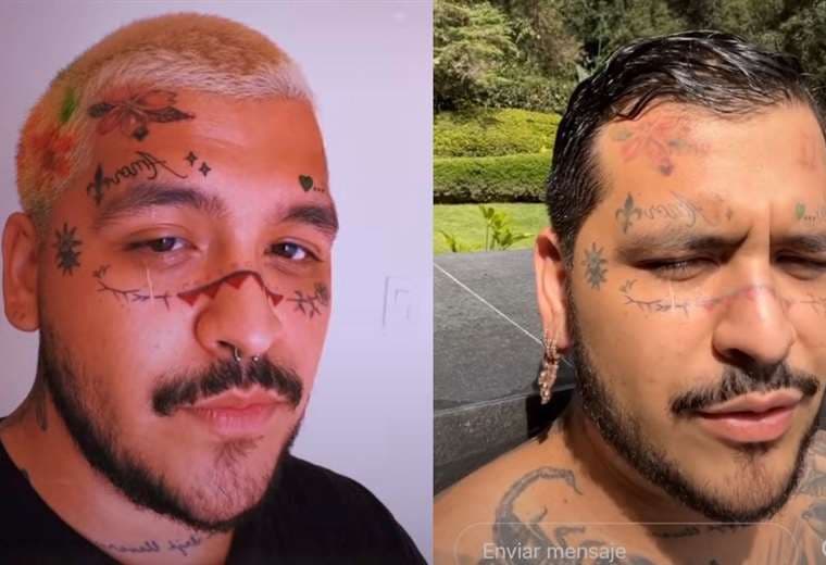 Así luce Christian Nodal tras borrarse los tatuajes de la cara