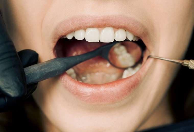 a mala higiene dental puede causar una serie de enfermedades crónicas importantes